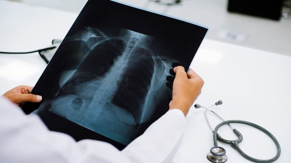 Government invests in NHS AI to accelerate cancer diagnoses